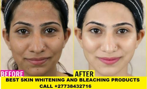 Skin Bleaching and whitening in Senagal +27738432716